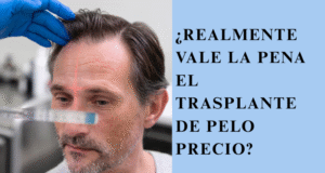 ¿Realmente vale la pena el trasplante de pelo precio? trasplante de pelo precio